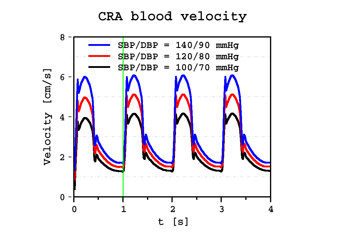 CRA velocity profile
