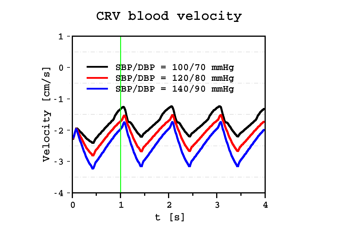 CRV velocity profile